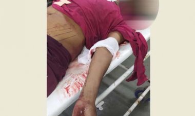 કાપોદ્રામાં નજીવી બાબતે યુવક પર ચપ્પુથી હુમલો થતાં હોસ્પિટલમાં દાખલ